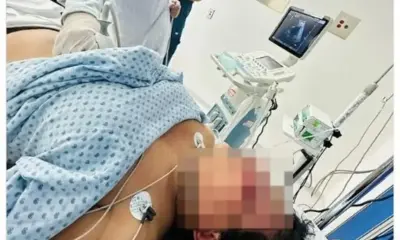 Paolita a punto de perder el ojo y con 2 costillas rotas tras golpiza de su prometido