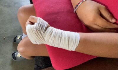 Piden a motociclista que atropelló a menor de 13 años se haga cargo de los gastos (+Vídeo)