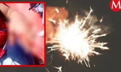 Amputan dedos de ambas manos a adolescente en Pachuca por explotar pirotecnia