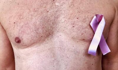 Piden ayuda para Daniel, es paciente de cáncer linfoma hodgkin