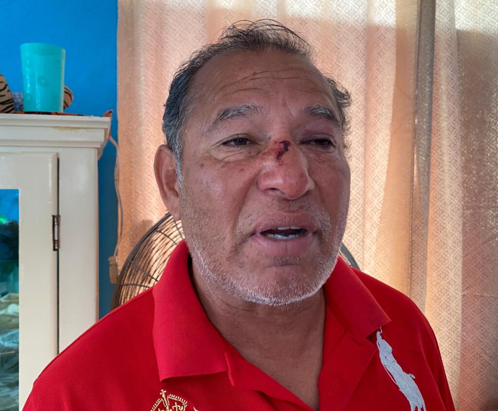 Convocan a marcha en apoyo del profesor Juan Carlos, víctima de lesiones y presunto intento de privación ilegal de la libertad dentro de SIMAC