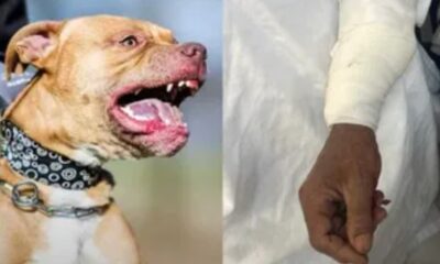 Adulto mayor es atacado por tres perros pitbull en Baja California