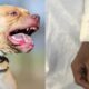 Adulto mayor es atacado por tres perros pitbull en Baja California