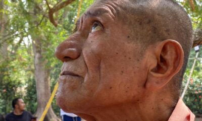 Piden ayuda para don «Chendo», necesita una prótesis