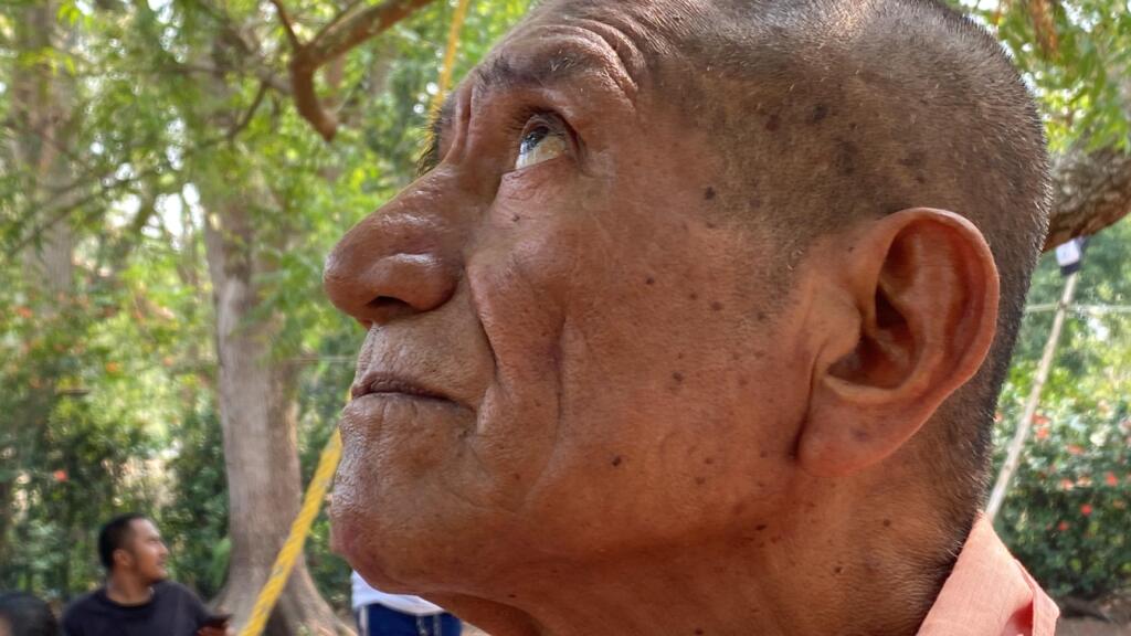 Piden ayuda para don «Chendo», necesita una prótesis