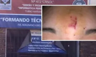 Profesor hiere a alumno en la cabeza con un borrador porque no guardó silencio