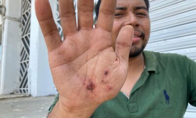 Chófer del taxi 2578 cargó combustible y huyó sin pagar; despachador resultó lesionado al intentar detenerlo