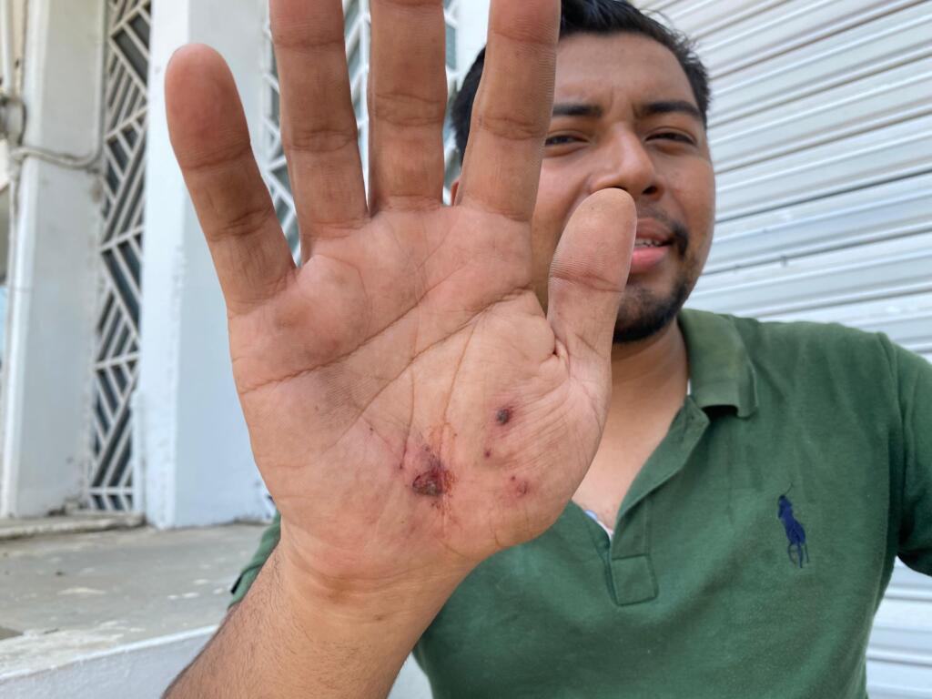 Chófer del taxi 2578 cargó combustible y huyó sin pagar; despachador resultó lesionado al intentar detenerlo