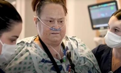 Fallece Lisa Pisano, la mujer que recibió trasplante de riñón de cerdo