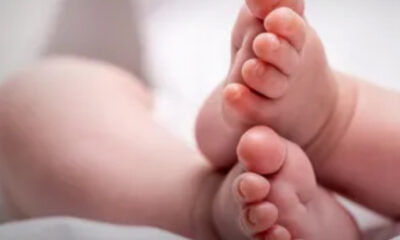 Médicos descubre un FETO creciendo en el cráneo de una bebé de un año