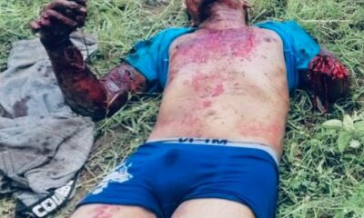 Explosión de granada causa heridos graves en Coatzacoalcos, Veracruz