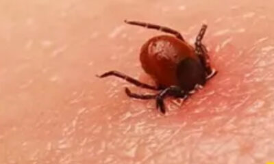 Cómo se transmite la Rickettsia, enfermedad que provocó la muerte de dos niños en Escobedo