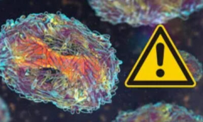 Mpox: ¿Cómo identificar las diferencias que hay entre las cepas de la viruela del mono?