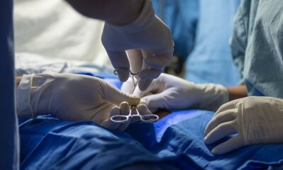 Informa IMSS Veracruz Sur sobre beneficios de la vasectomía sin bisturí