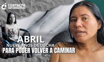 (+VIDEO) *Mujer busca recaudar 300 mil pesos para su quinta operación después de ser atr0pell4da en 2016*