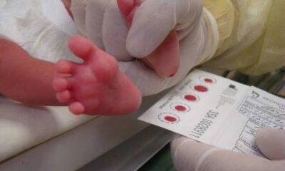 Informa IMSS Veracruz Sur sobre detección y tratamiento de enfermedades metabólicas congénitas