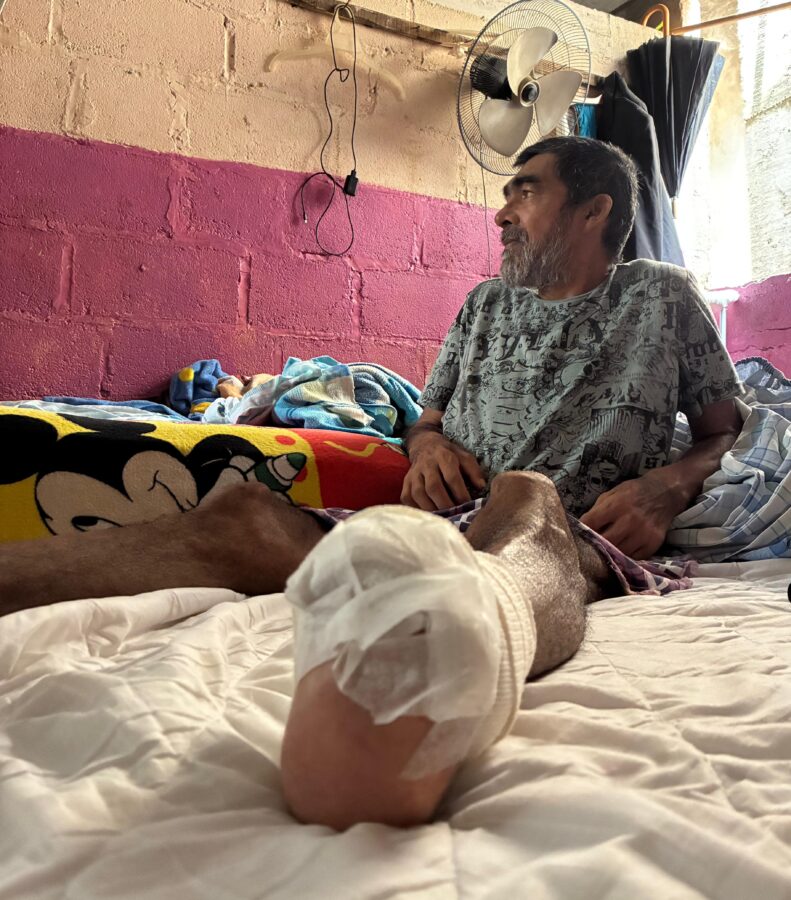 (+VÍDEO) La lucha silenciosa de Tomás: cuatro amputaciones y una batalla contra la diabetes en Minatitlán