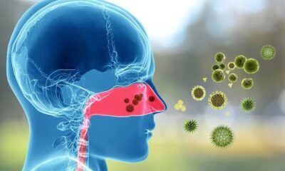 Invita IMSS Veracruz Sur a informarse para prevenir y tratar enfermedades alérgicas