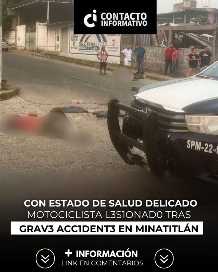 Motociclista con estado de salud del1cad0 tras gr@ve acc1dent3 en Minatitlán