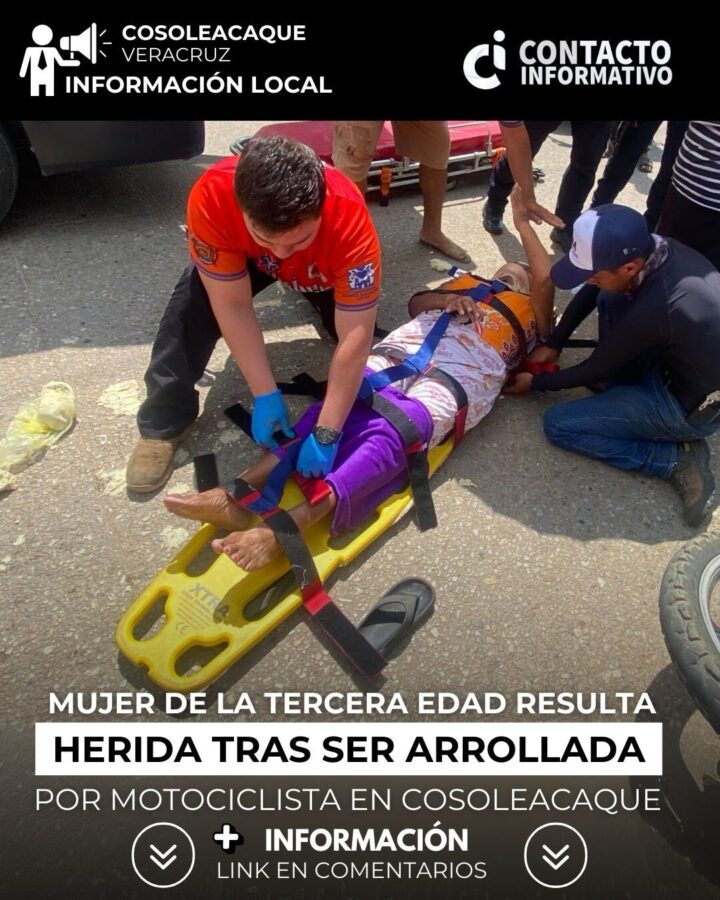 Mujer de la tercera edad resulta h3rida tras ser arr0llada por motociclista en Cosoleacaque