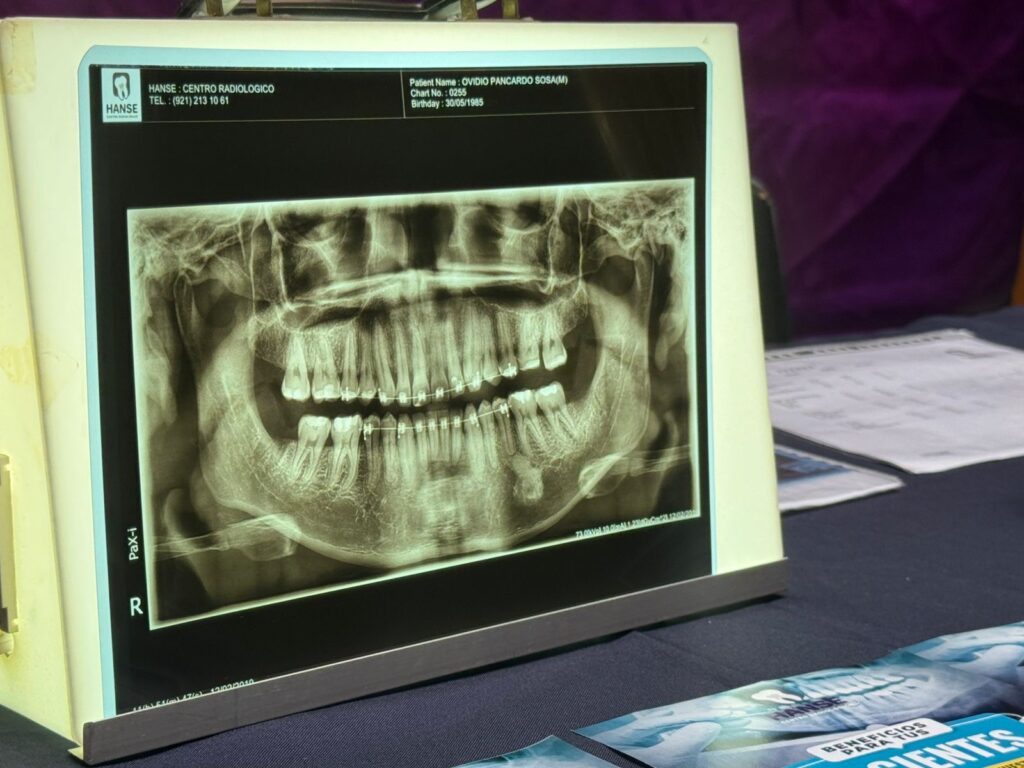 *Dentistas consideran que impuestos a bebidas azucaradas y cigarros es recaudatoria, autoridades deben enfocarse en seguir fomentando la salud bucal*
