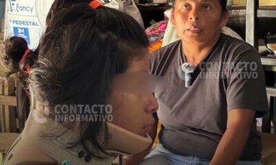 (+VIDEO) Adolescente de 13 años en Minatitlán sufre graves secuelas tras recibir un balonazo en el cuello; su familia pide ayuda