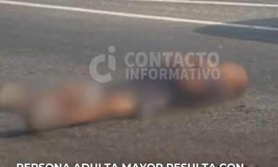 Persona adulta mayor resulta con graves lesiones en accidente vial frente a la colonia Congreso