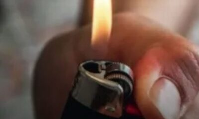 Encendedor explota en cara de un niño de la colonia Magisterial de Acayucan.