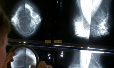 Entra en vigor reforma de Morena que elimina la prioridad legal a enfermedades de alto costo como el cáncer