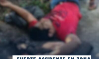 🚨 Fuerte accidente en zona rural de Minatitlán deja a motociclista sin rodilla