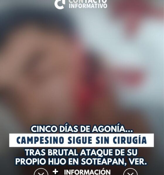Cinco días de agonía: campesino sigue sin cirugía tras brutal ataque de su propio hijo en Soteapan, Ver.