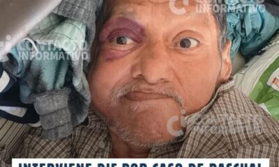 (+VIDEO) Interviene DIF por caso de Pascual, adulto mayor abandonado; su salud preocupa en Minatitlán
